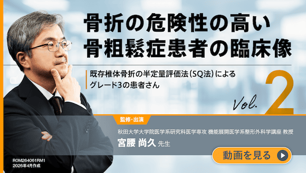 サムネイル_骨折の危険性の高い骨粗鬆症患者の臨床像 vol.2