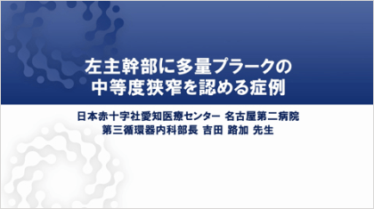 ハイリスク症例を考える　左主幹部に多量プラークの中等度狭窄を認める症例