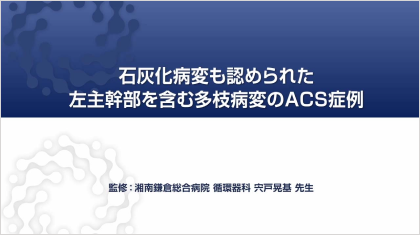 ハイリスク症例を考える 石灰化病変も認められた左主幹部を含む多枝病変のACS症例