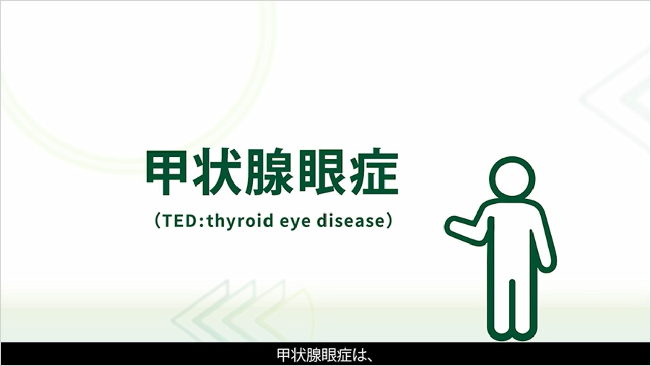 サムネイル_知っておきたい！ 甲状腺眼症への適切な治療介入のポイント 