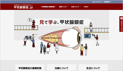 サムネイル_一般の皆様向けサイト甲状腺眼症.jp