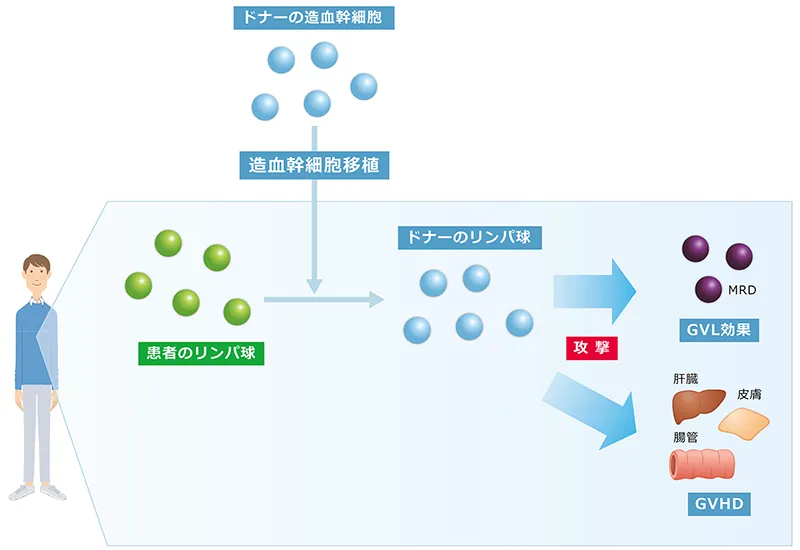 図_造血幹細胞移植後の合併症