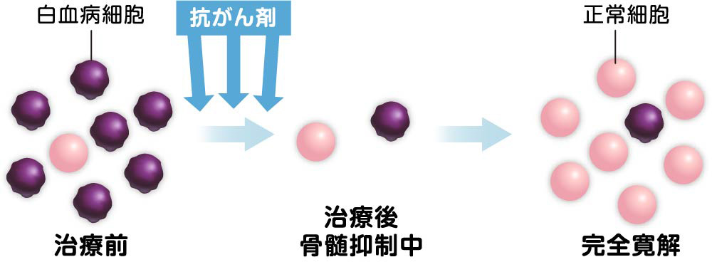 図_寛解導入療法の基本と治療薬の選択