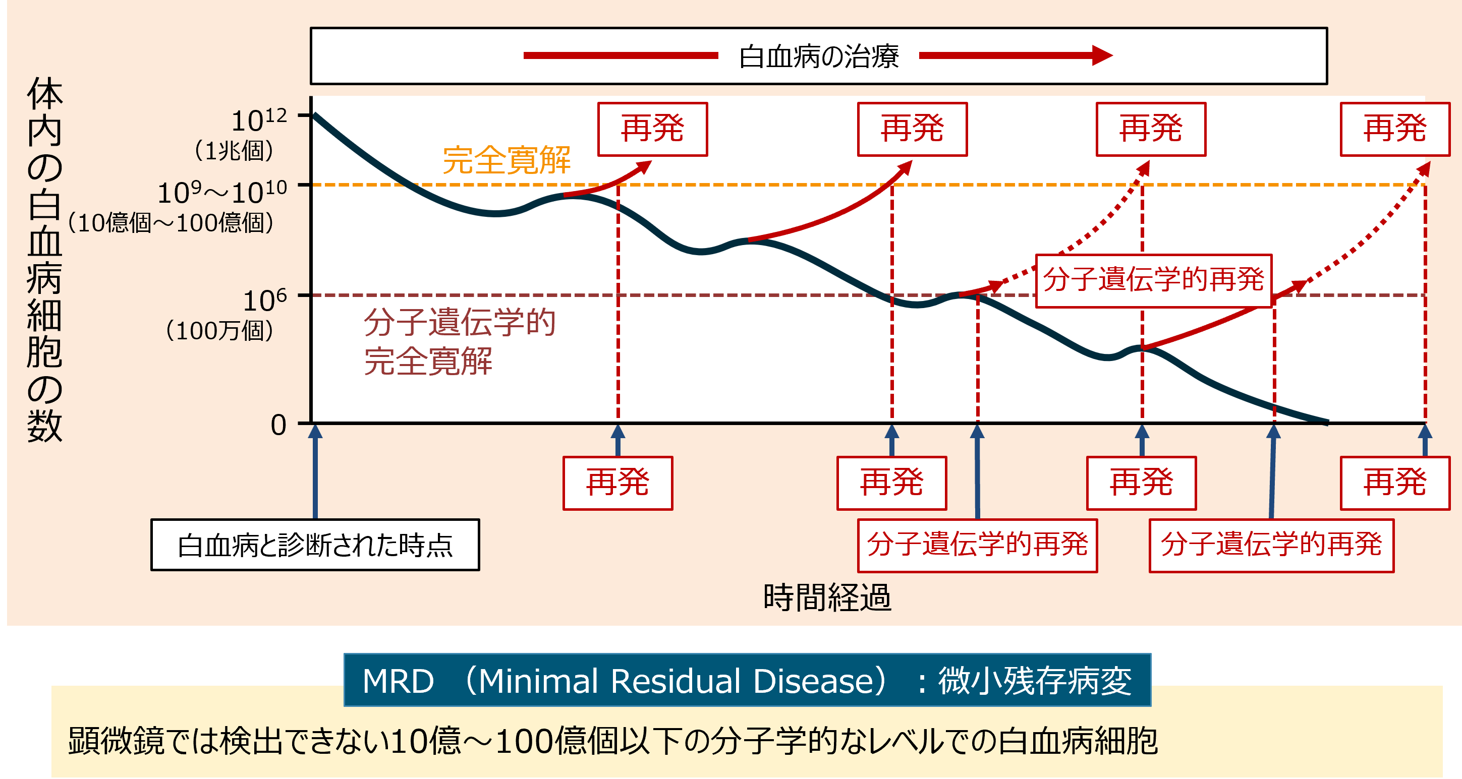 図_再発と白血病細胞の数の変化