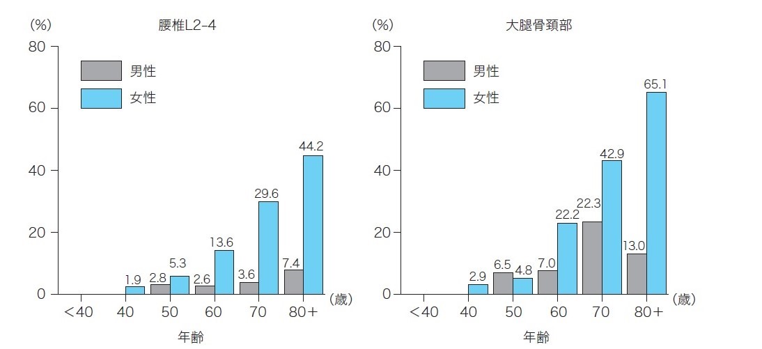 図3 年齢階層別にみた骨粗鬆症の有病率