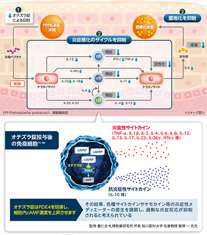 掌蹠膿疱症の病態